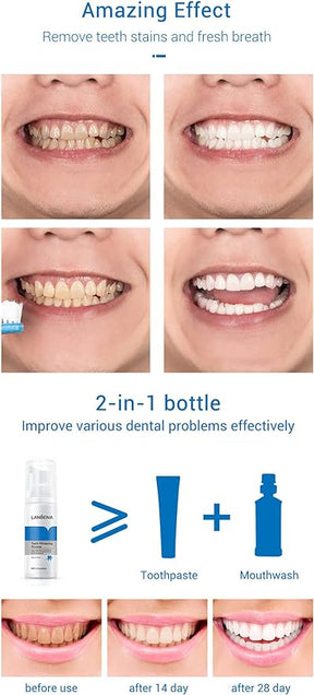 Lanbena™ | Teeth Whitening Mousse